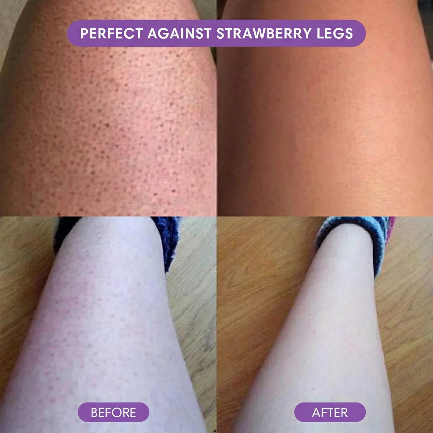 SilkEase™ Hair Removal Set