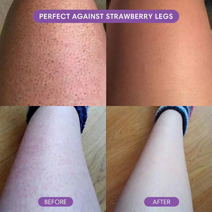 SilkEase™ Hair Removal Set